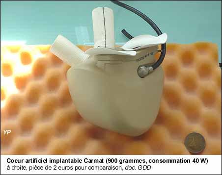 Coeur artificiel implantable Carmat (900 grammes, consommation 40 W)