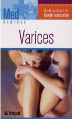 Varices